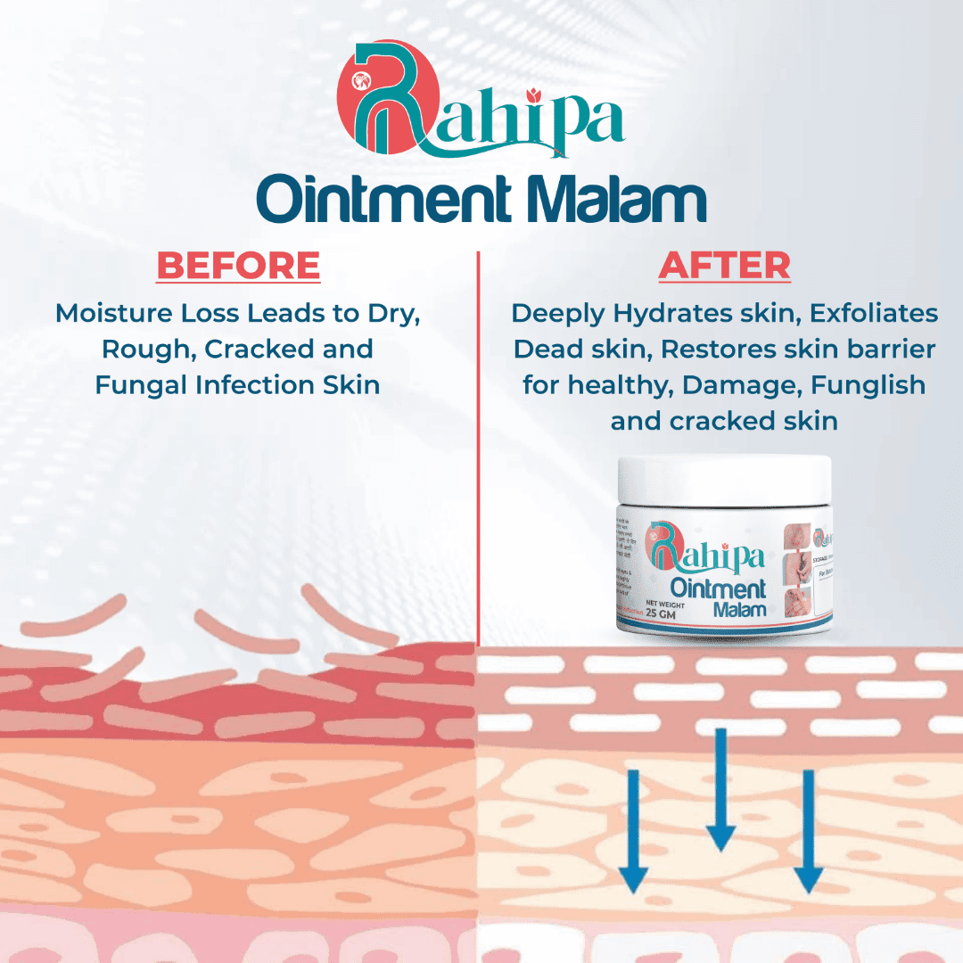 RAHIPA MALAM Dad Khaj Malam | Khujli Malam, Fungal Infection Cream, Ringworm Treatment | Ayurvedic Skin Ointment, Herbal Malam, Eczema & Skin Itching Relief (Buy 2 get 1 free)